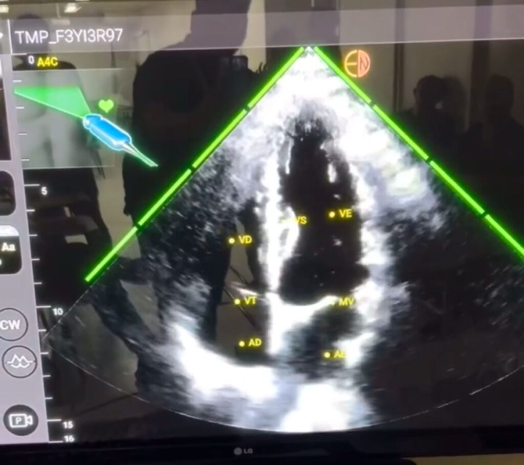 ULtrassom4